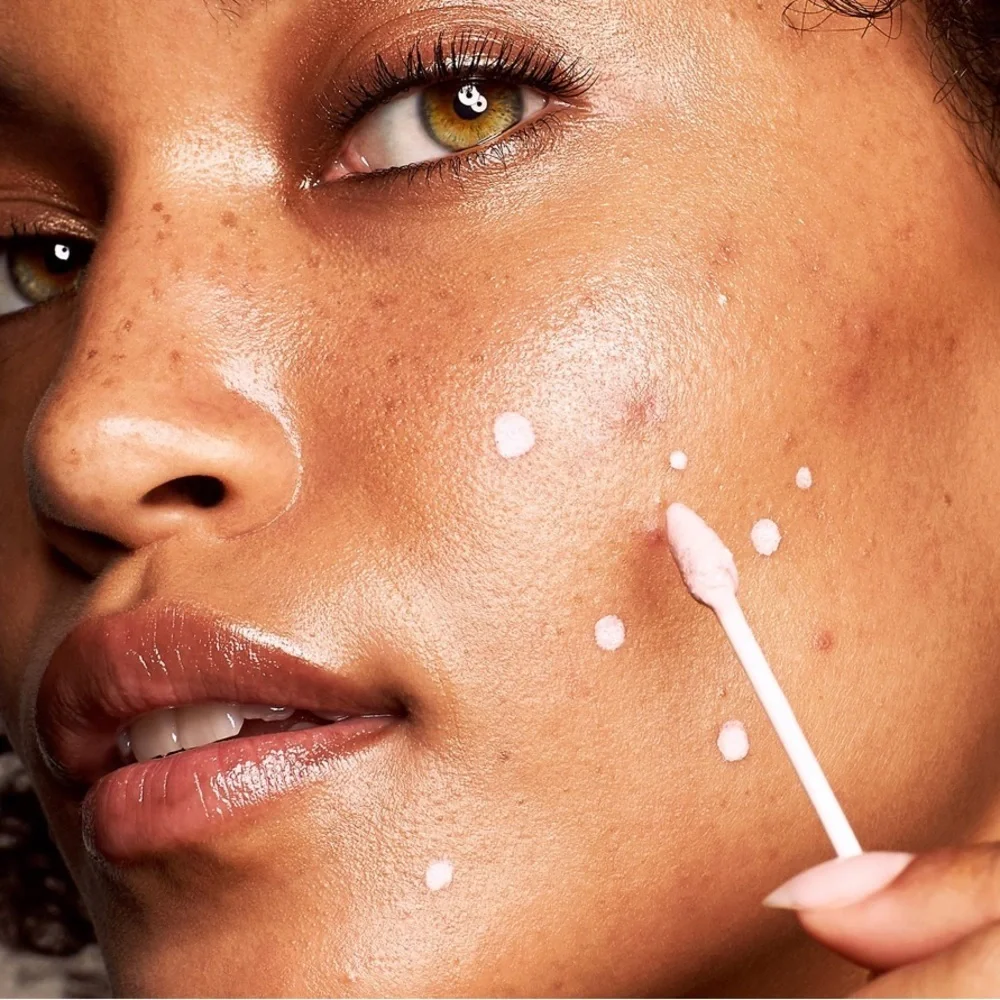✨Kate Somerville ERADIKATE® ACNE TREATMENT
